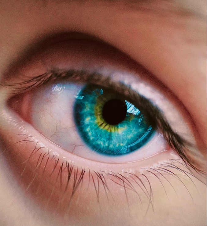 Mieux voir, sans lunette, c&rsquo;est mieux vivre !